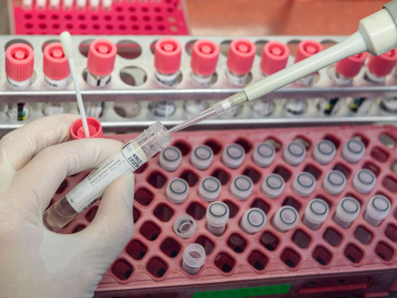 6.480 castellano-manchegos participarán en el estudio de seroprevalencia del Ministerio de Sanidad - imagen 1