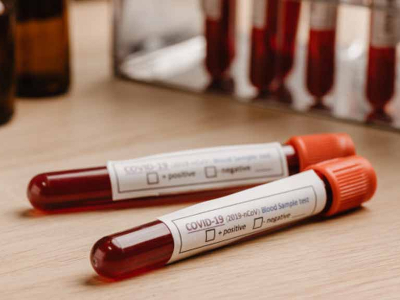 CLM podrá realizar hasta 6.000 PCR diarias en la Fase 1 de desescalada - imagen 1