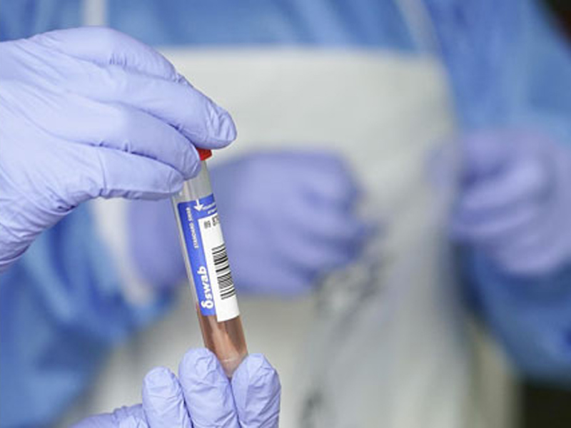 Cuenca confirma 1 solo caso realizado con PCR y ningún fallecido - imagen 1