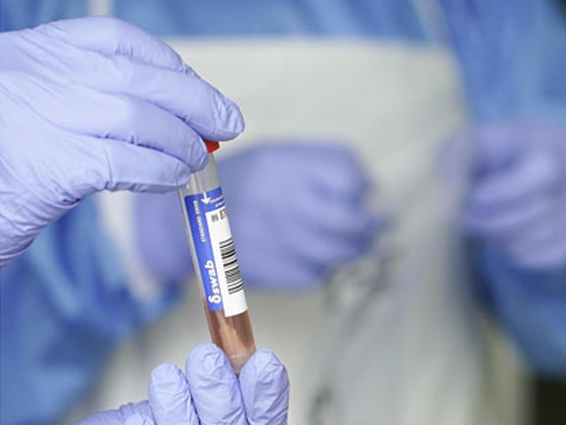 Cuenca registra 3 nuevos casos y ningún fallecido por Covid-19 - imagen 1