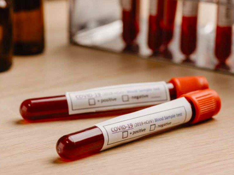 Se registran cinco nuevos casos de coronavirus en Cuenca y Albacete - imagen 1