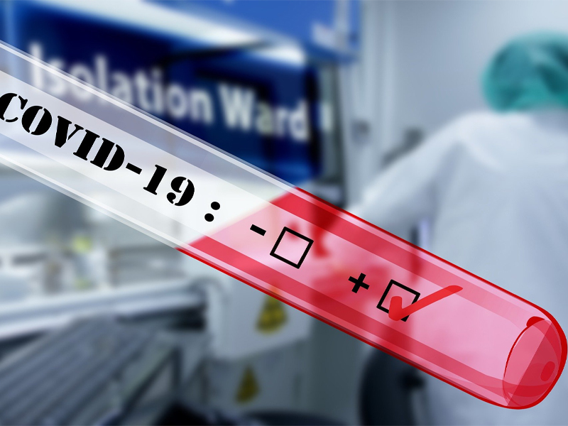 El fin de semana deja 11 nuevos casos confirmados de COVID-19 en la provincia de Cuenca - imagen 1