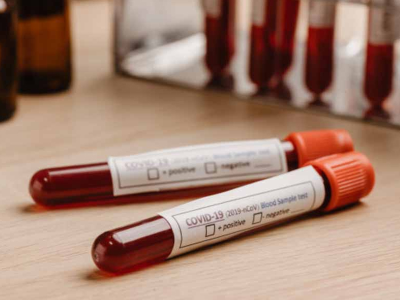 186 nuevos casos positivos de COVID-19 en CLM - imagen 1