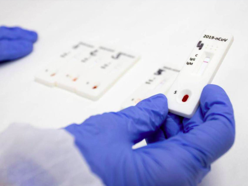 Los test de anticuerpos de la Covid llegan a las farmacias conquenses - imagen 1