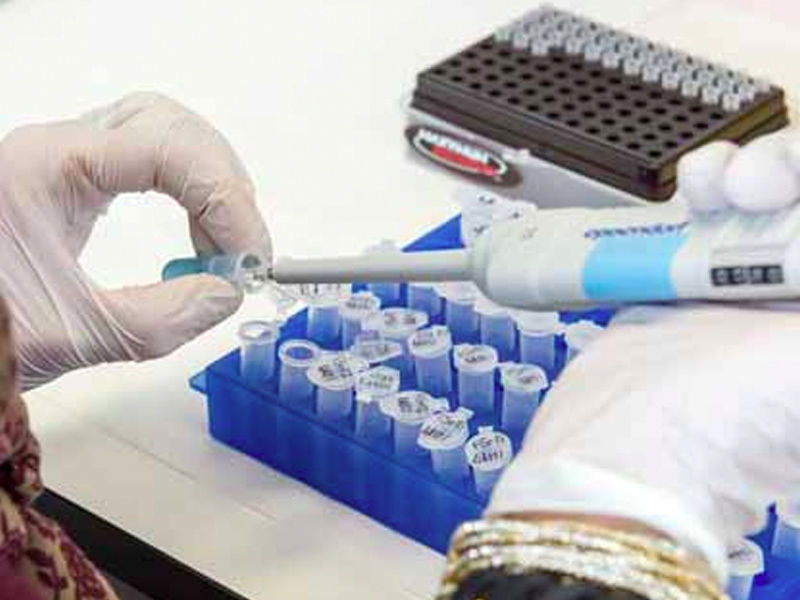 Cuenca confirmó 94 nuevos casos de coronavirus y ningún fallecido - imagen 1