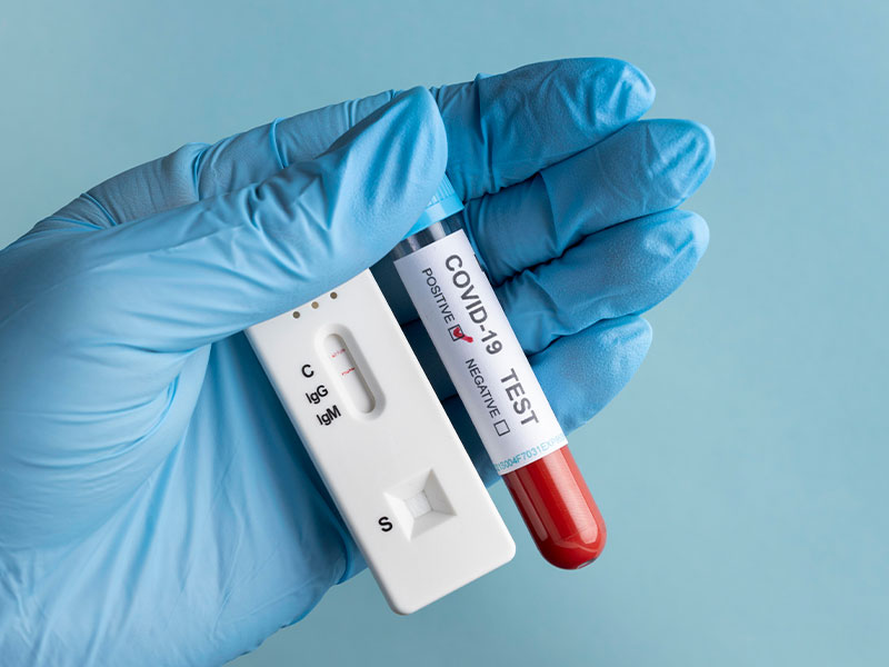 Cuenca registra únicamente 4 casos de coronavirus - imagen 1