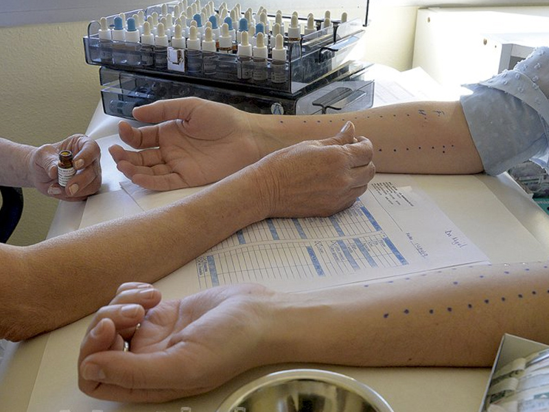 La falta de precipitaciones agrava las alergias a los pólenes invernales - imagen 1